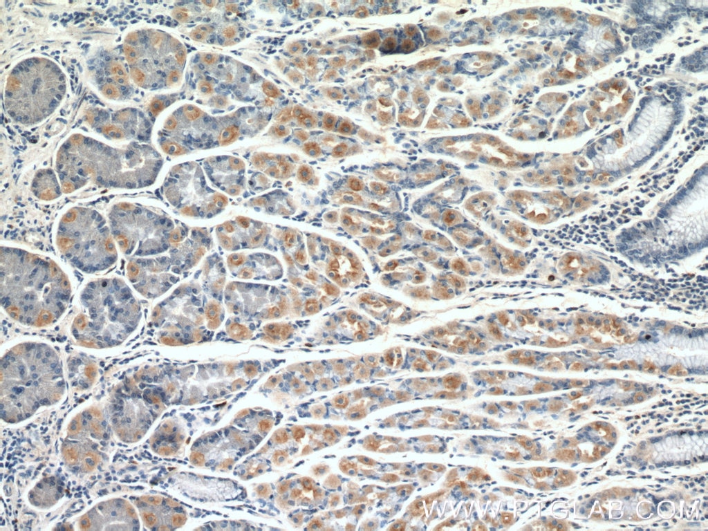 Immunohistochemistry (IHC) staining of human stomach tissue using GDAP2 Polyclonal antibody (17246-1-AP)