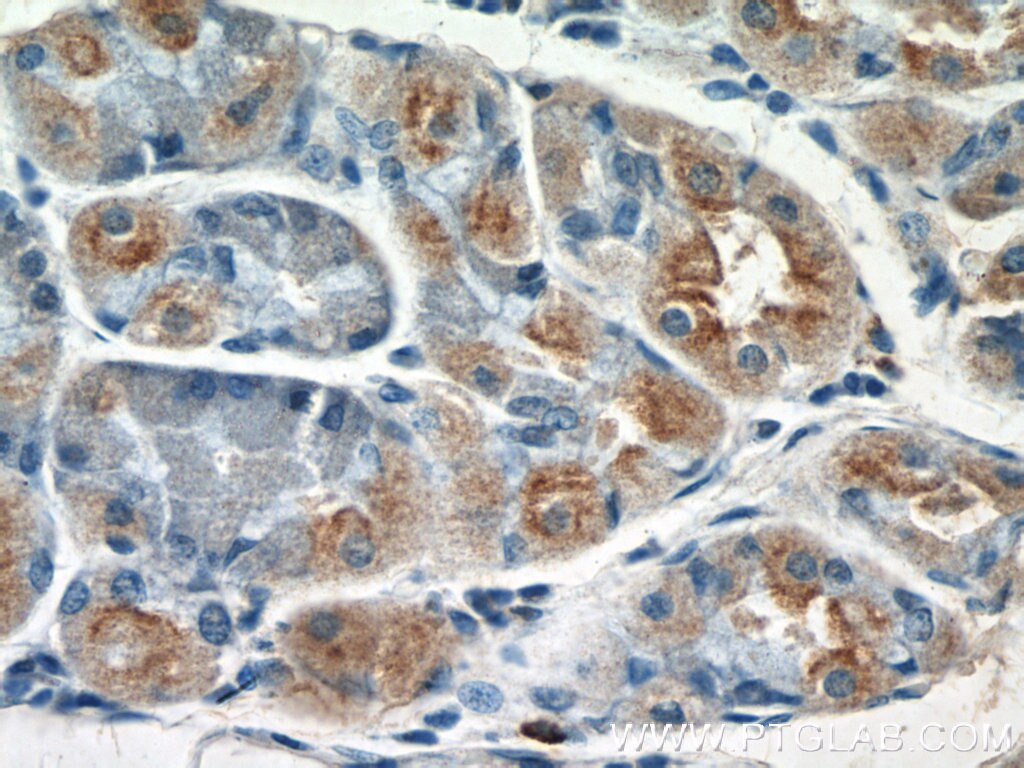 IHC staining of human stomach using 17246-1-AP