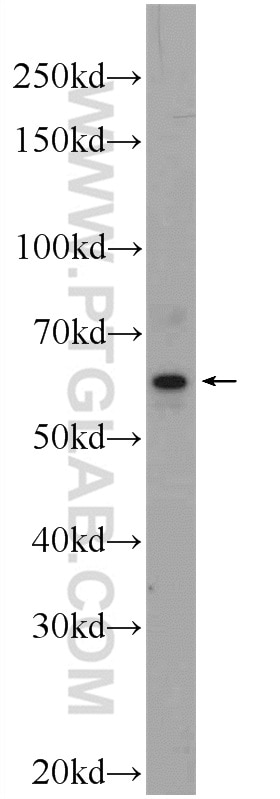 Western Blot (WB) analysis of Raji cells using GDAP2 Polyclonal antibody (17246-1-AP)