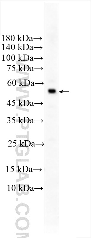 Western Blot (WB) analysis of Raji cells using GDAP2 Polyclonal antibody (17246-1-AP)