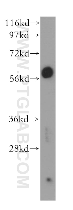 Western Blot (WB) analysis of PC-3 cells using GDE1 Polyclonal antibody (11272-2-AP)