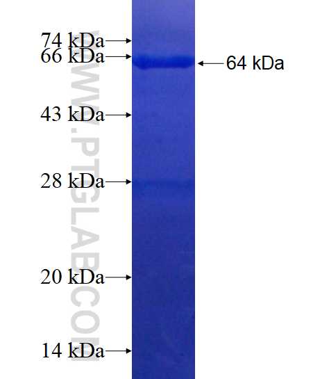 GDE1 fusion protein Ag1821 SDS-PAGE