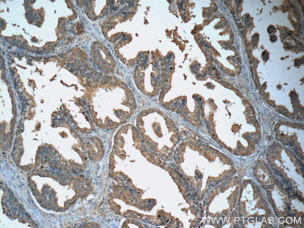 Immunohistochemistry (IHC) staining of human prostate hyperplasia tissue using GDEP Polyclonal antibody (22744-1-AP)