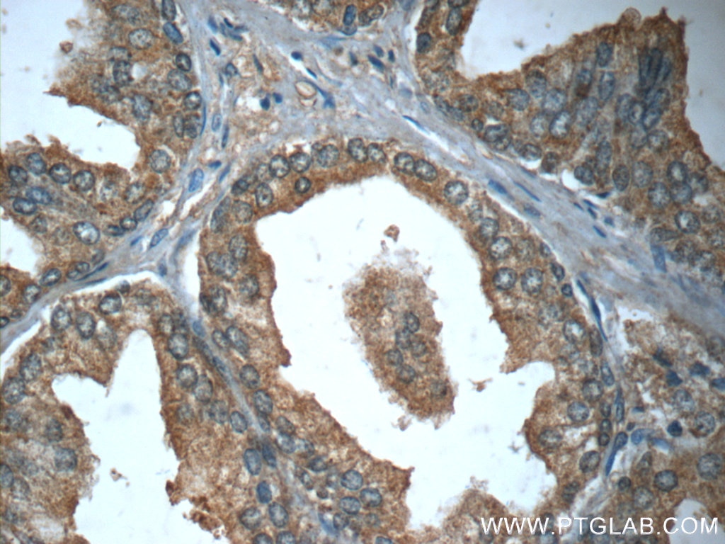 Immunohistochemistry (IHC) staining of human prostate hyperplasia tissue using GDEP Polyclonal antibody (22744-1-AP)
