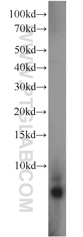 Western Blot (WB) analysis of PC-3 cells using GDEP Polyclonal antibody (22744-1-AP)