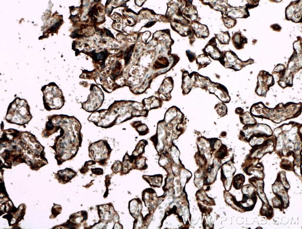 Immunohistochemistry (IHC) staining of human placenta tissue using GDF15 Polyclonal antibody (27455-1-AP)