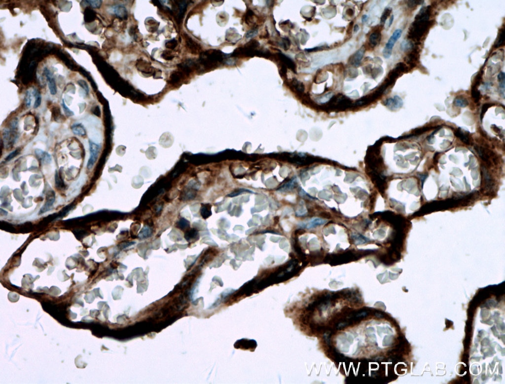 Immunohistochemistry (IHC) staining of human placenta tissue using GDF15 Polyclonal antibody (27455-1-AP)