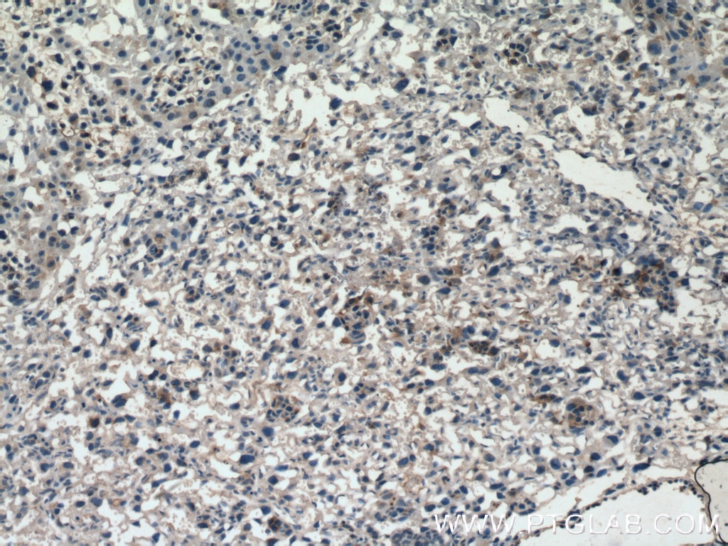 Immunohistochemistry (IHC) staining of mouse placenta tissue using GDF15 Polyclonal antibody (27455-1-AP)