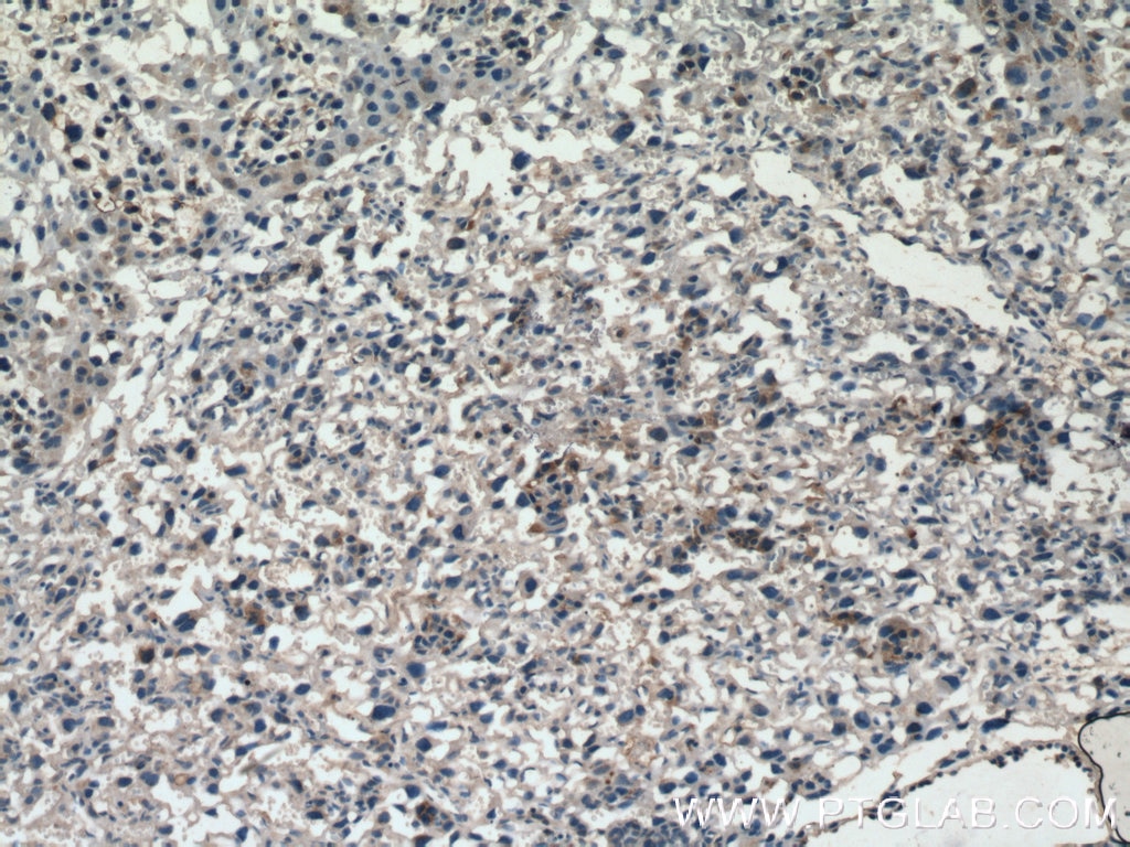 IHC staining of mouse placenta using 27455-1-AP