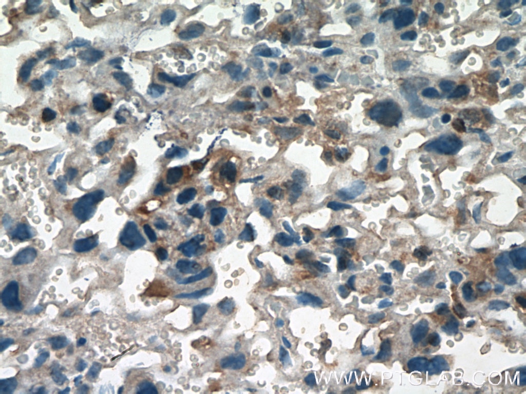 Immunohistochemistry (IHC) staining of mouse placenta tissue using GDF15 Polyclonal antibody (27455-1-AP)