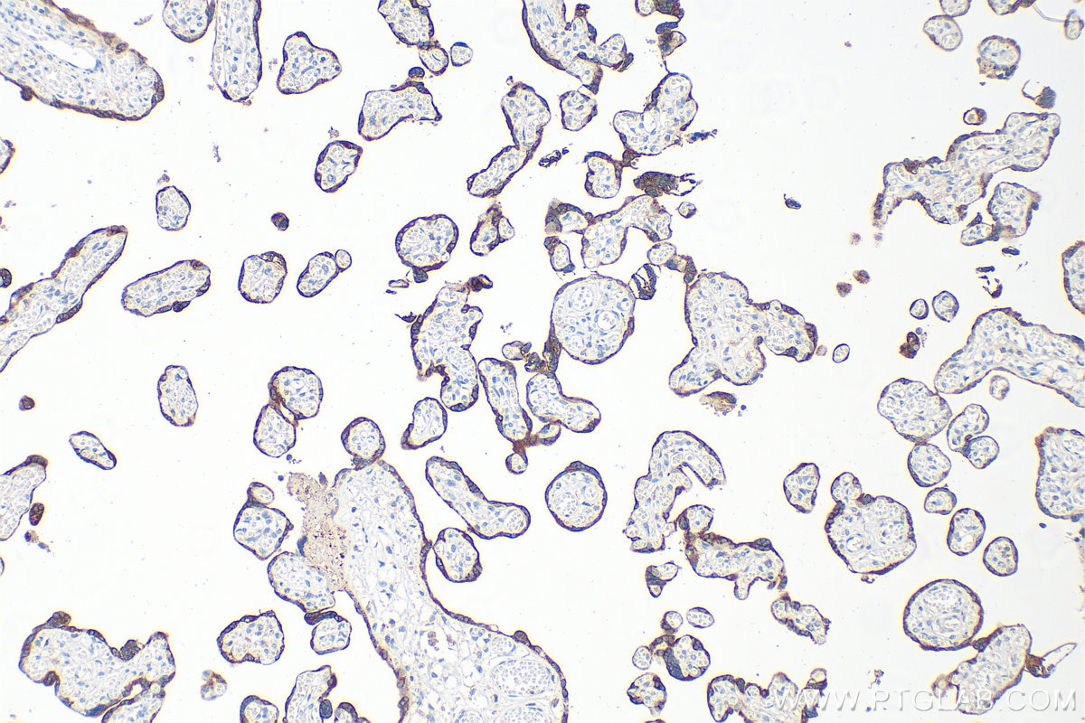 Immunohistochemistry (IHC) staining of human placenta tissue using GDF-15 Polyclonal antibody (27455-1-AP)