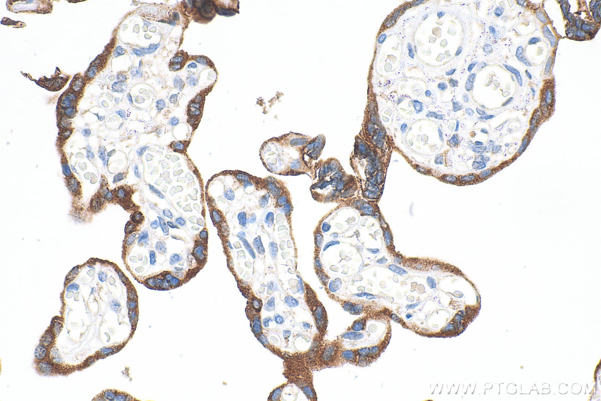 Immunohistochemistry (IHC) staining of human placenta tissue using GDF-15 Polyclonal antibody (27455-1-AP)