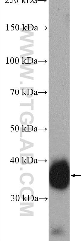 Western Blot (WB) analysis of human placenta tissue using GDF15 Polyclonal antibody (27455-1-AP)