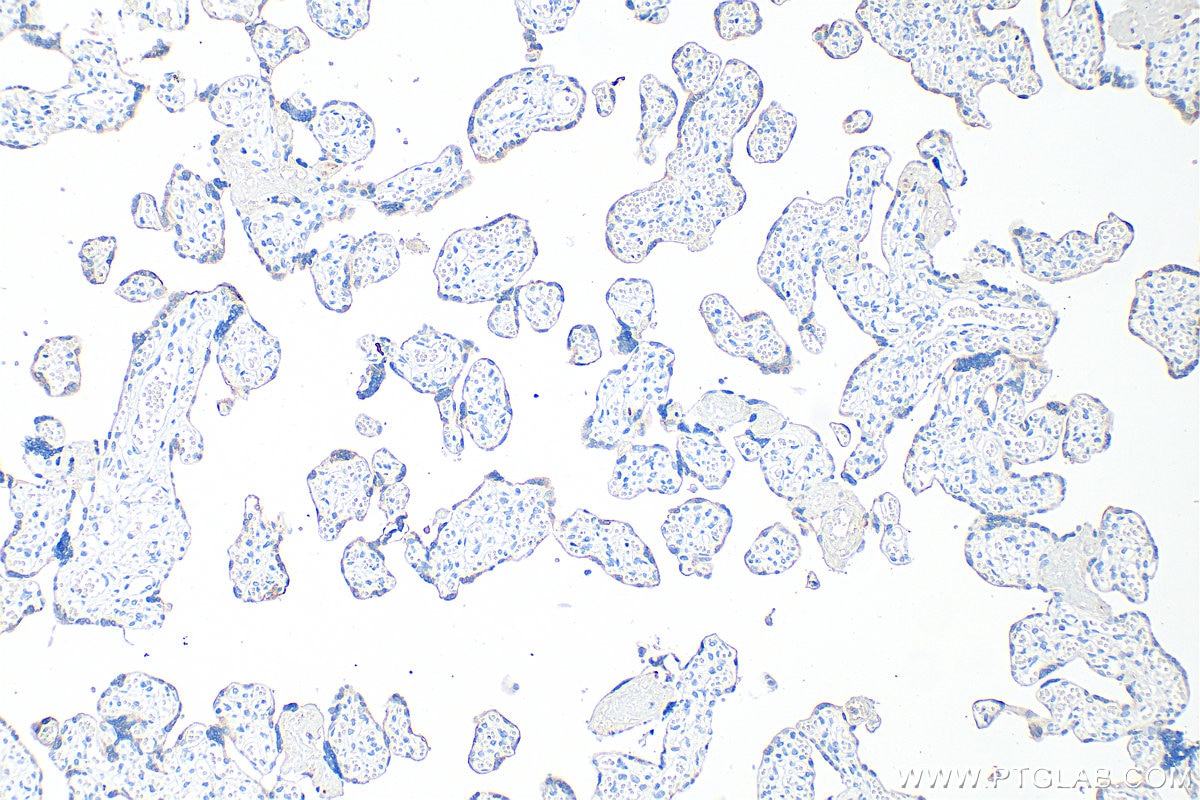 Immunohistochemistry (IHC) staining of human placenta tissue using GDF-15 Monoclonal antibody (68768-1-Ig)