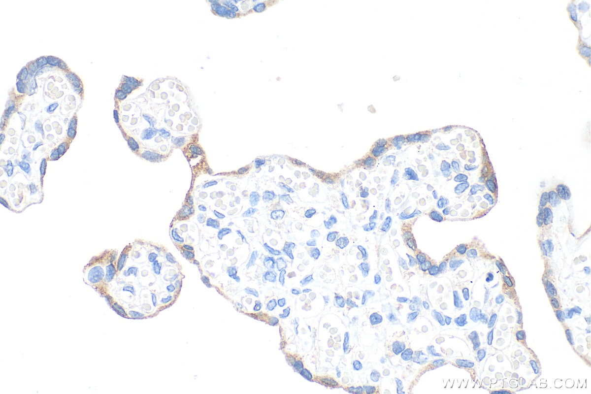 Immunohistochemistry (IHC) staining of human placenta tissue using GDF-15 Monoclonal antibody (68768-1-Ig)