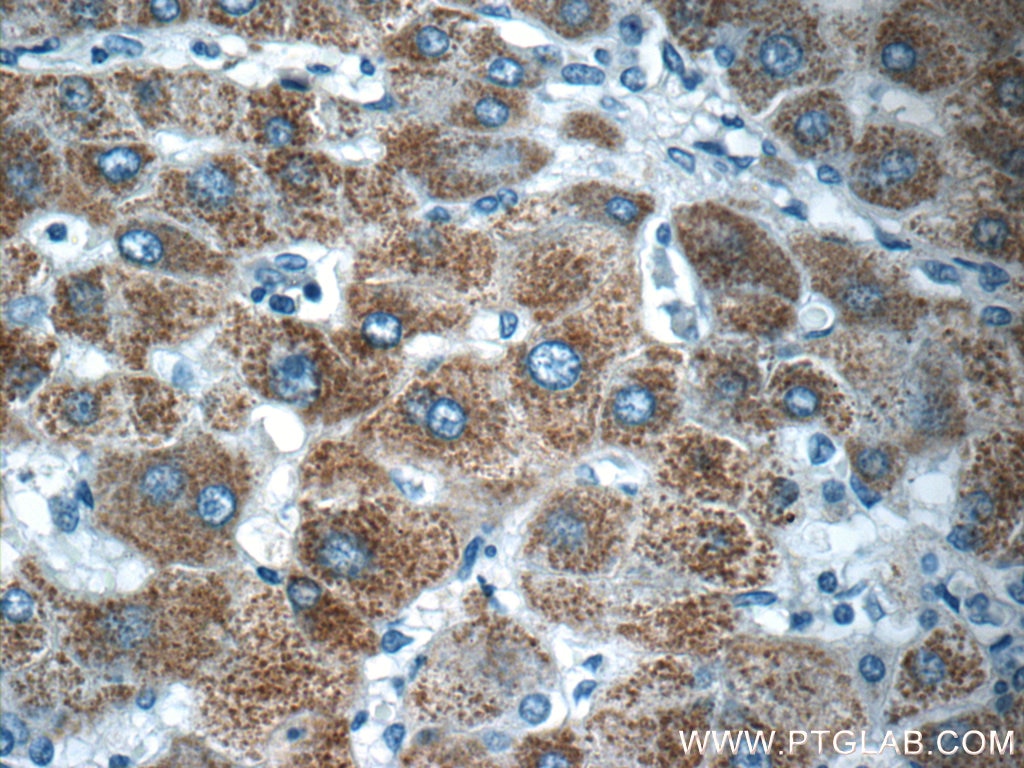 BMP9 Polyclonal antibody