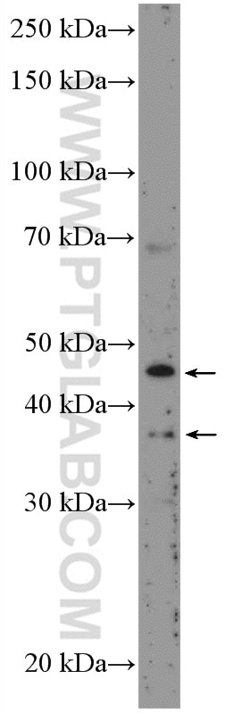 WB analysis of SMMC-7721 using 17769-1-AP