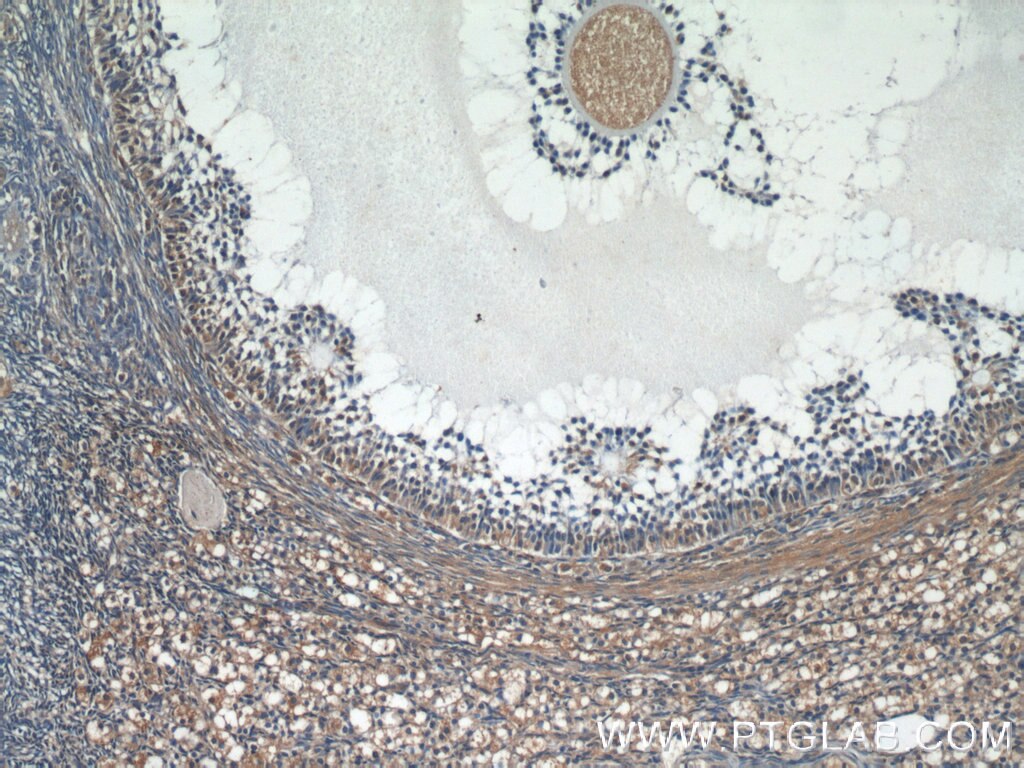 IHC staining of human ovary using 19894-1-AP