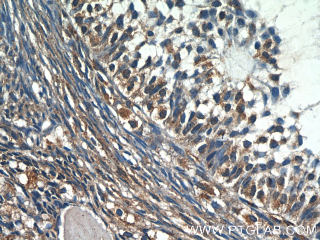 Immunohistochemistry (IHC) staining of human ovary tissue using GDF9 Polyclonal antibody (19894-1-AP)