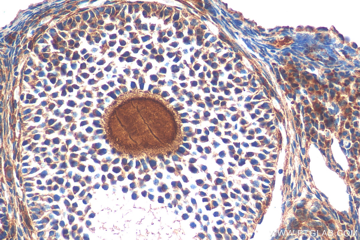 Immunohistochemistry (IHC) staining of mouse ovary tissue using GDF9 Polyclonal antibody (29309-1-AP)