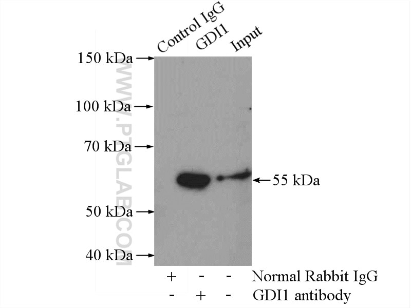 Immunoprecipitation (IP) experiment of mouse brain tissue using GDI1 Polyclonal antibody (10249-1-AP)