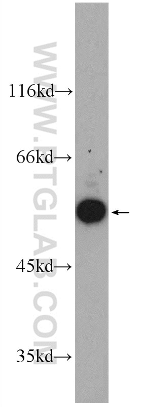 Western Blot (WB) analysis of mouse brain tissue using GDI1 Polyclonal antibody (10249-1-AP)