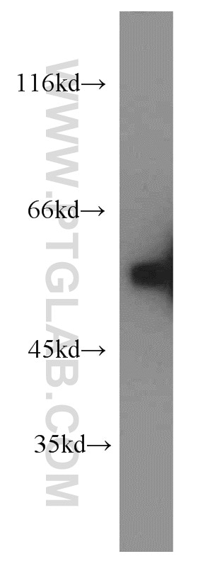 Western Blot (WB) analysis of human brain tissue using GDI1 Polyclonal antibody (10249-1-AP)