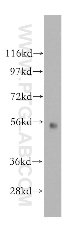 Western Blot (WB) analysis of human brain tissue using GDI1 Polyclonal antibody (10249-1-AP)