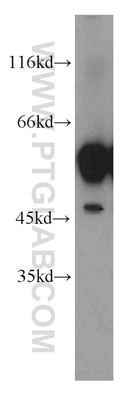 Western Blot (WB) analysis of mouse brain tissue using GDI1 Polyclonal antibody (55214-1-AP)