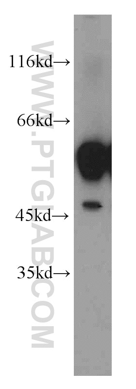 WB analysis of mouse brain using 55214-1-AP