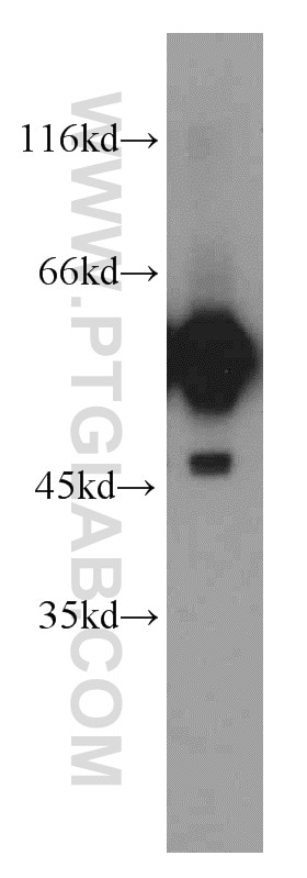 Western Blot (WB) analysis of mouse brain tissue using GDI1 Polyclonal antibody (55214-1-AP)