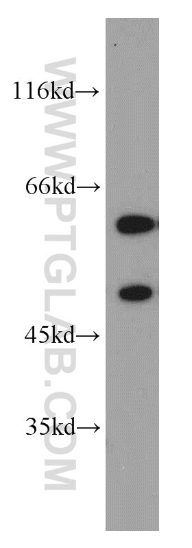 Western Blot (WB) analysis of SH-SY5Y cells using GDI1 Polyclonal antibody (55214-1-AP)