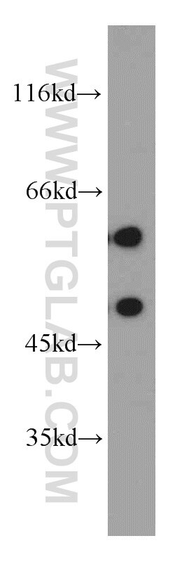 Western Blot (WB) analysis of SH-SY5Y cells using GDI1 Polyclonal antibody (55214-1-AP)