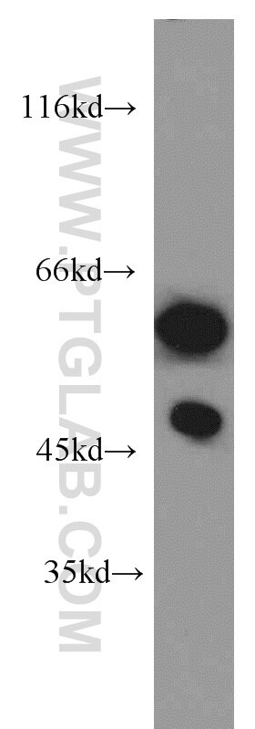 WB analysis of SH-SY5Y using 55214-1-AP