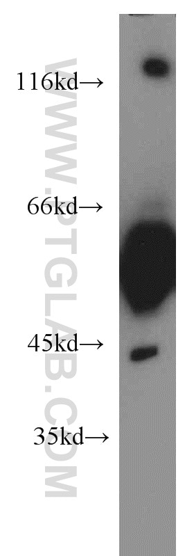 Western Blot (WB) analysis of human brain tissue using GDI1 Polyclonal antibody (55214-1-AP)