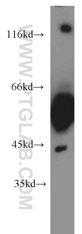 WB analysis of human brain using 55214-1-AP