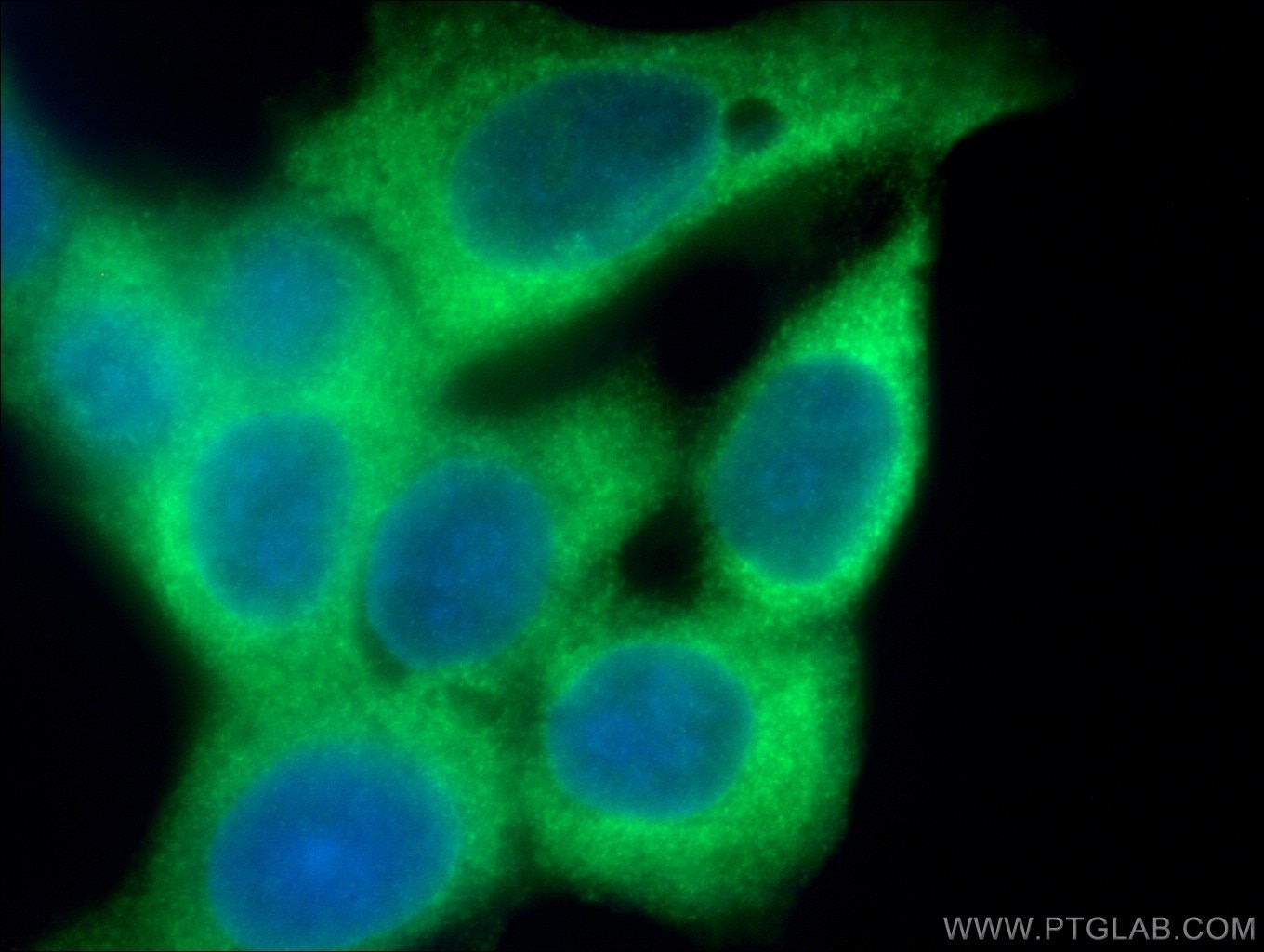 Immunofluorescence (IF) / fluorescent staining of MCF-7 cells using GDI1 Monoclonal antibody (66434-1-Ig)