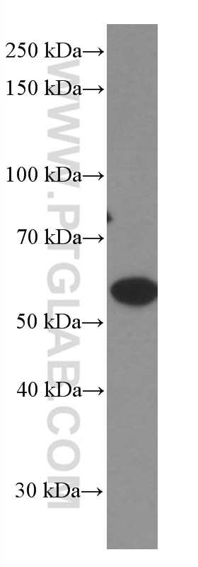 Western Blot (WB) analysis of HEK-293 cells using GDI1 Monoclonal antibody (66434-1-Ig)
