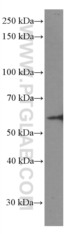 Western Blot (WB) analysis of Neuro-2a cells using GDI1 Monoclonal antibody (66434-1-Ig)