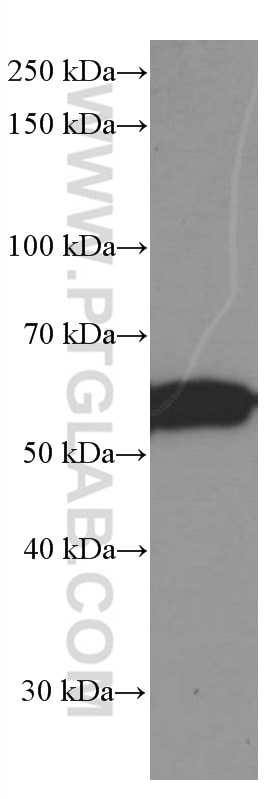 Western Blot (WB) analysis of rat brain tissue using GDI1 Monoclonal antibody (66434-1-Ig)