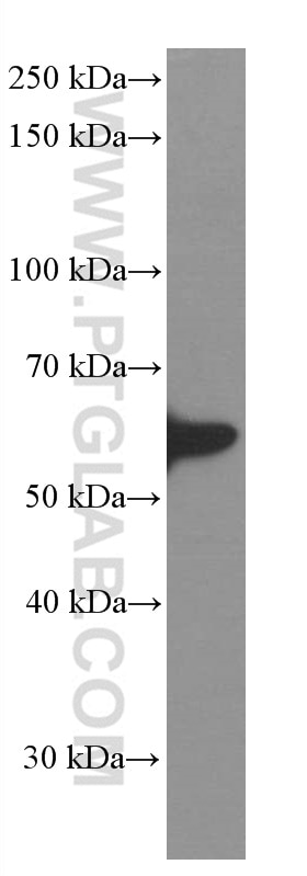 Western Blot (WB) analysis of mouse brain tissue using GDI1 Monoclonal antibody (66434-1-Ig)
