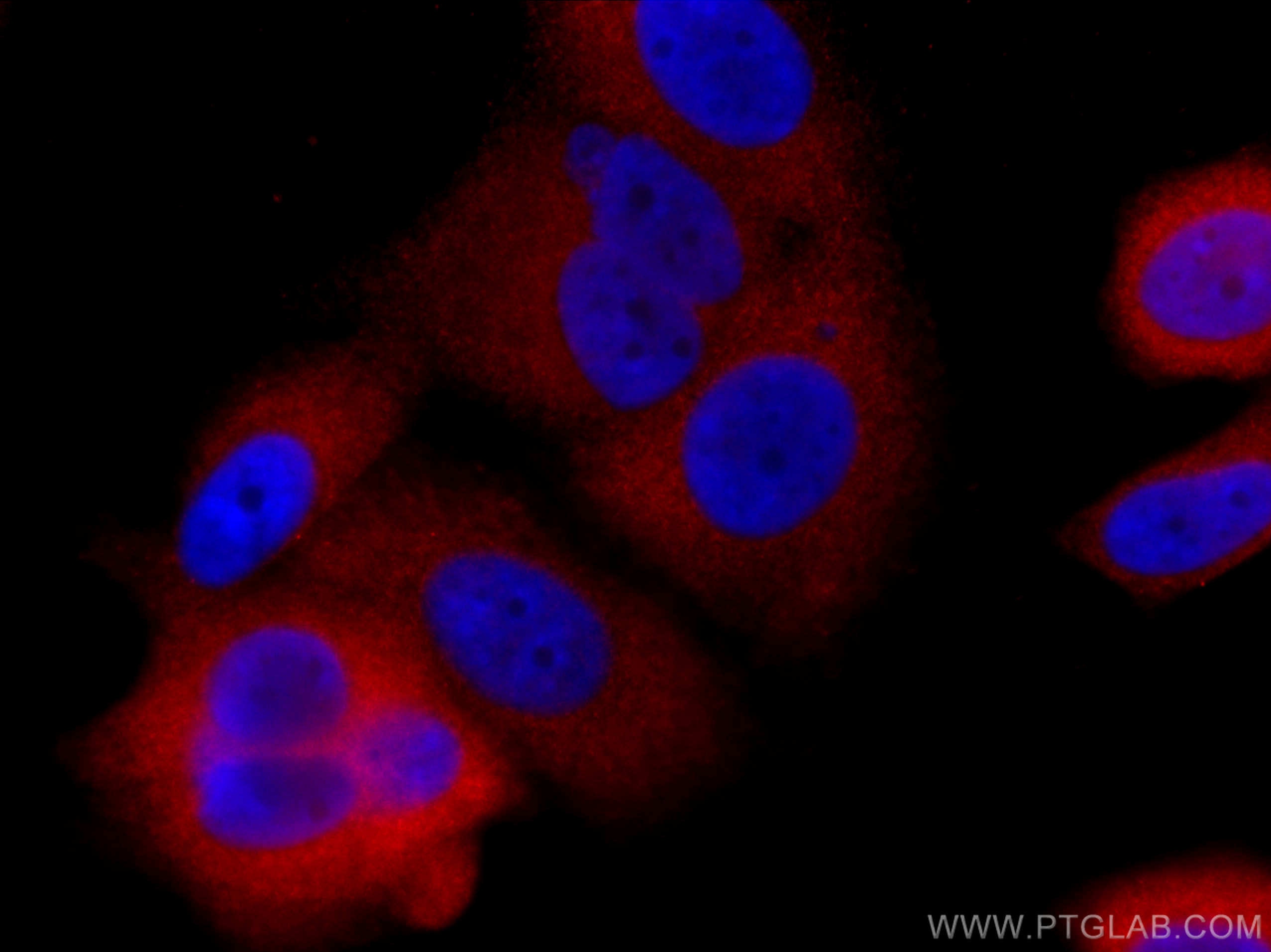 Immunofluorescence (IF) / fluorescent staining of MCF-7 cells using CoraLite®594-conjugated GDI1 Monoclonal antibody (CL594-66434)