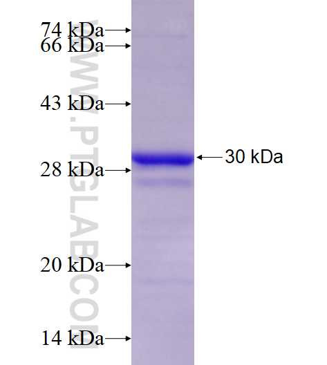 GDI1 fusion protein Ag17511 SDS-PAGE