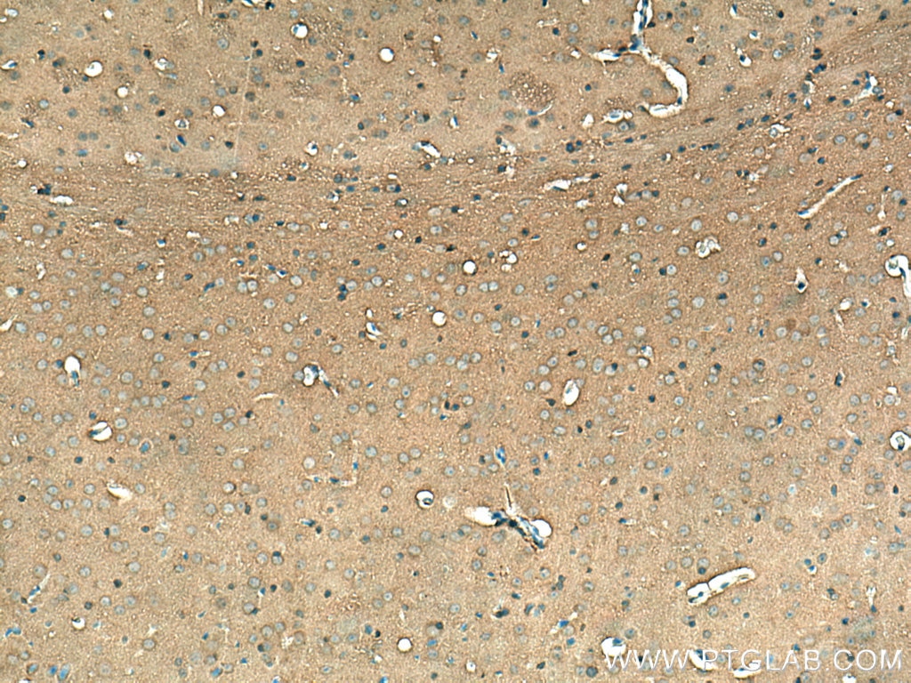 IHC staining of mouse brain using 10116-1-AP