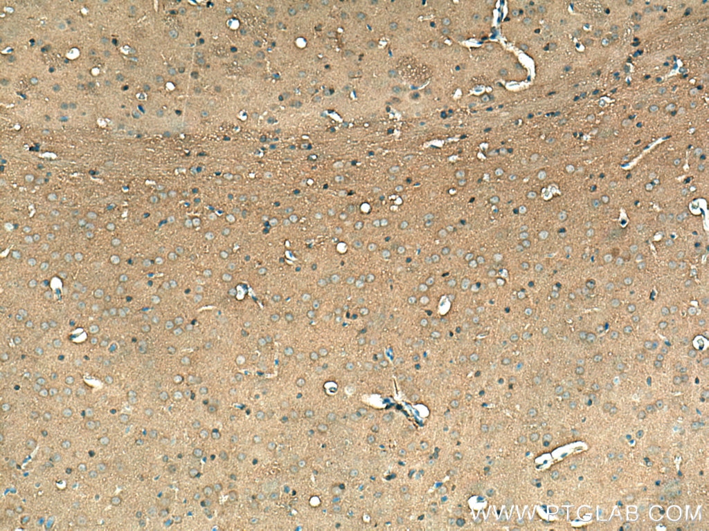 Immunohistochemistry (IHC) staining of mouse brain tissue using GDI2 Polyclonal antibody (10116-1-AP)