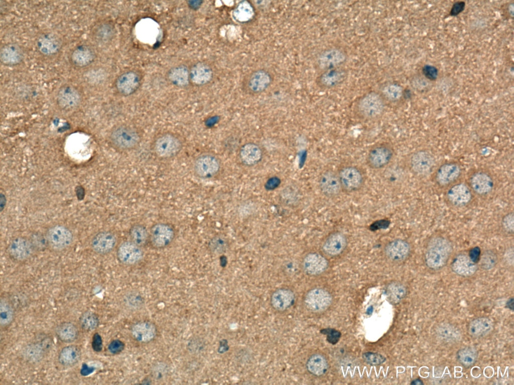 IHC staining of mouse brain using 10116-1-AP