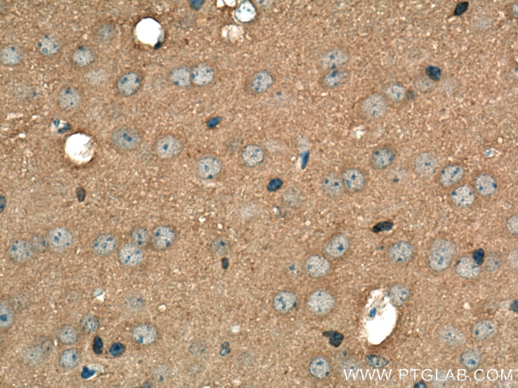 Immunohistochemistry (IHC) staining of mouse brain tissue using GDI2 Polyclonal antibody (10116-1-AP)