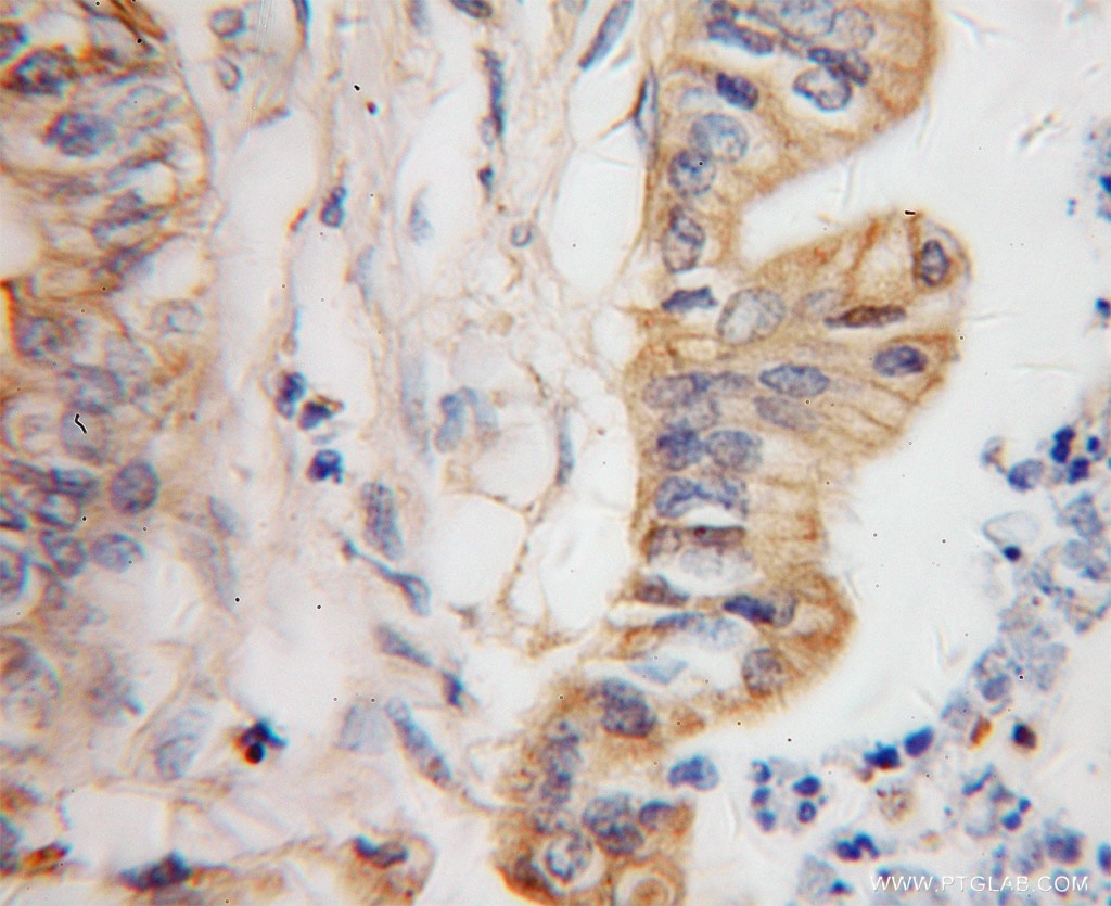 GDI2 Polyclonal antibody