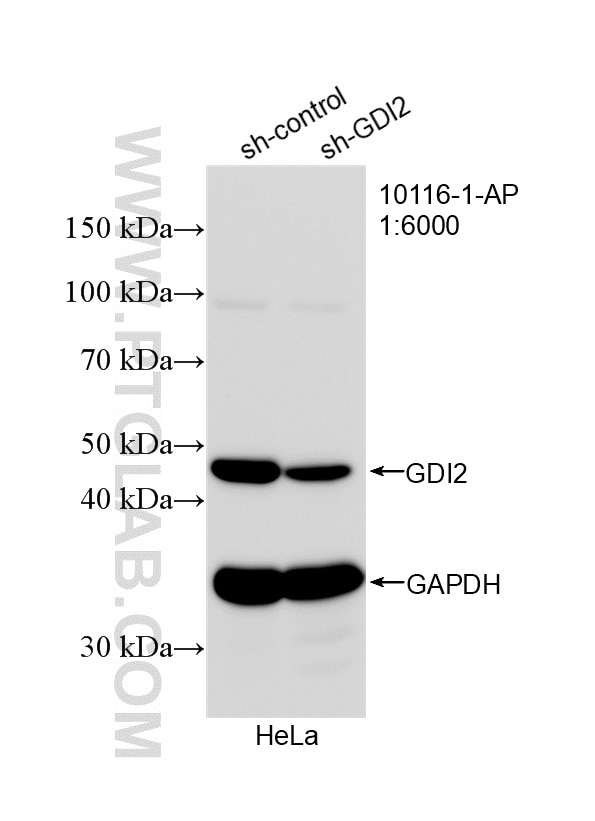 WB analysis of HeLa using 10116-1-AP Western Blot (WB) analysis of HeLa cells using GDI2 Polyclonal antibody (10116-1-AP)
