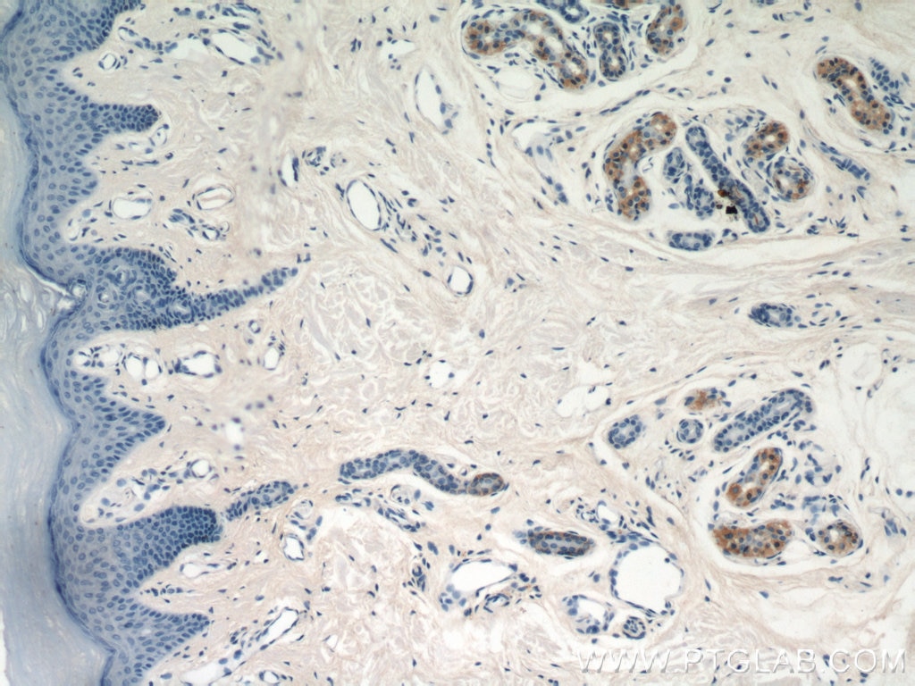 Immunohistochemistry (IHC) staining of human skin tissue using GDI2 Polyclonal antibody (55096-1-AP)